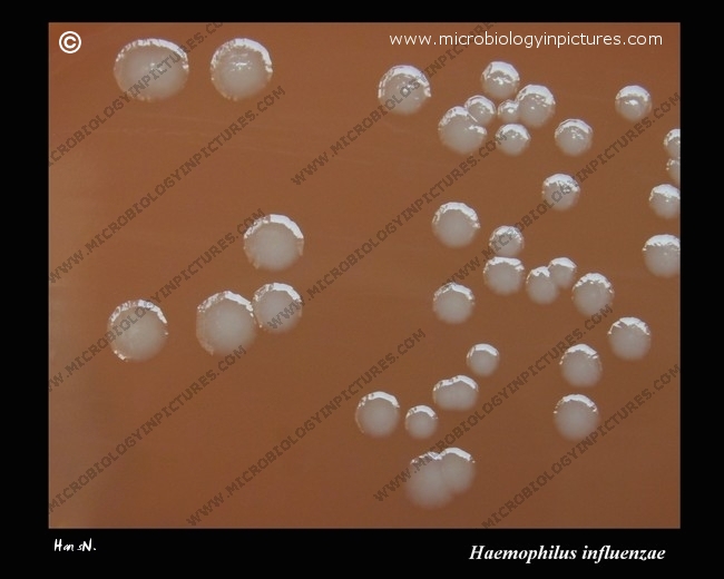 haemophilus influenzae colonies on chocolate agar